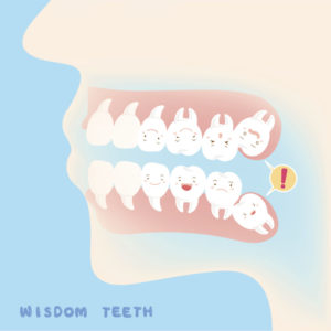 wisdom teeth removal in New Bern North Carolina
