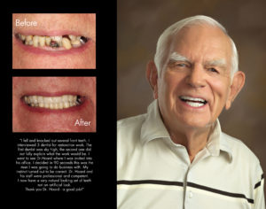 Bert, New Bern North Carolina cosmetic dentist patient photos