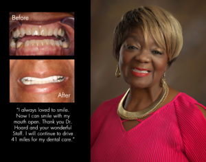 Johnnie, New Bern North Carolina cosmetic dentist patient photos