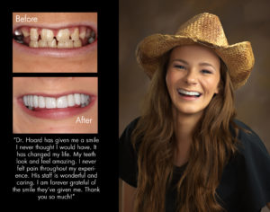 Katelyn, New Bern North Carolina cosmetic dentist patient photos