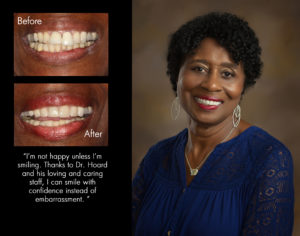 Lilli, New Bern North Carolina cosmetic dentist photos