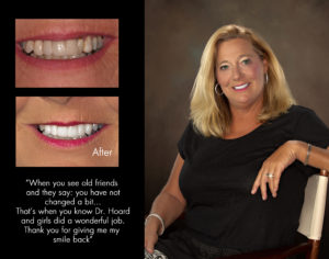 Marlene, New Bern North Carolina cosmetic dentist patient photos