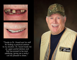 Ronald, New Bern North Carolina cosmetic dentist patient photos