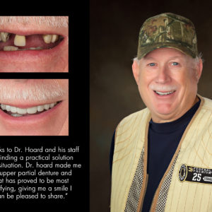 Ronald, New Bern North Carolina cosmetic dentist patient photos