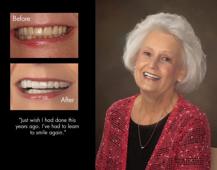 Cosmetic Dentistry in New Bern, NC