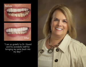 Terri, New Bern North Carolina cosmetic dentist photos