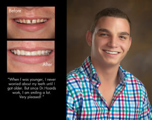 Thomas, New Bern North Carolina cosmetic dentist patient photos