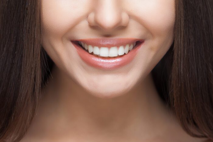 Smile Makeover in New Bern NC
