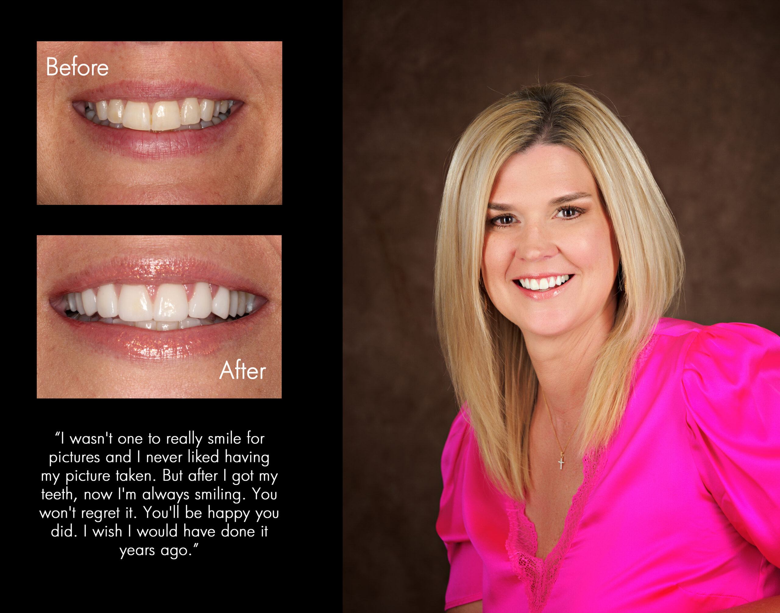 Patient before and after dental care at Hoard & Hoard Cosmetic and Restorative Dentistry